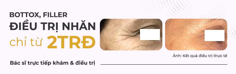 mediskin-dieu-tri-nhan-tan-an