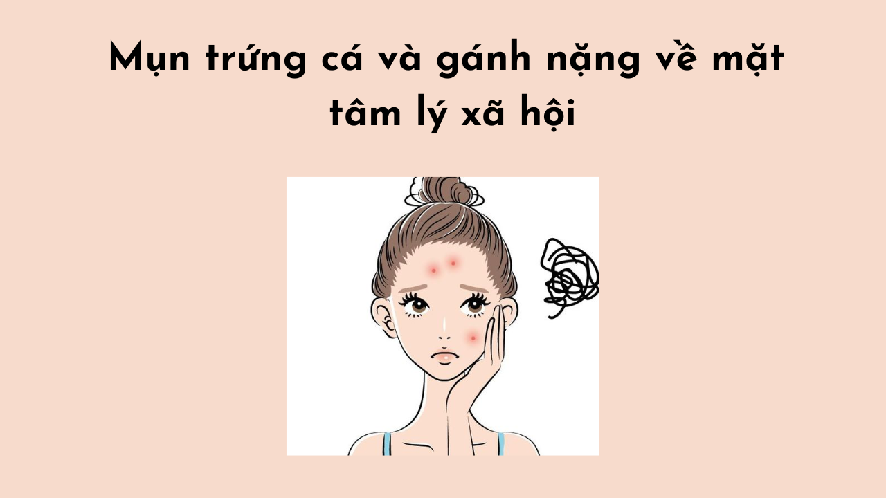 Gánh nặng tâm lý mụn trứng cá