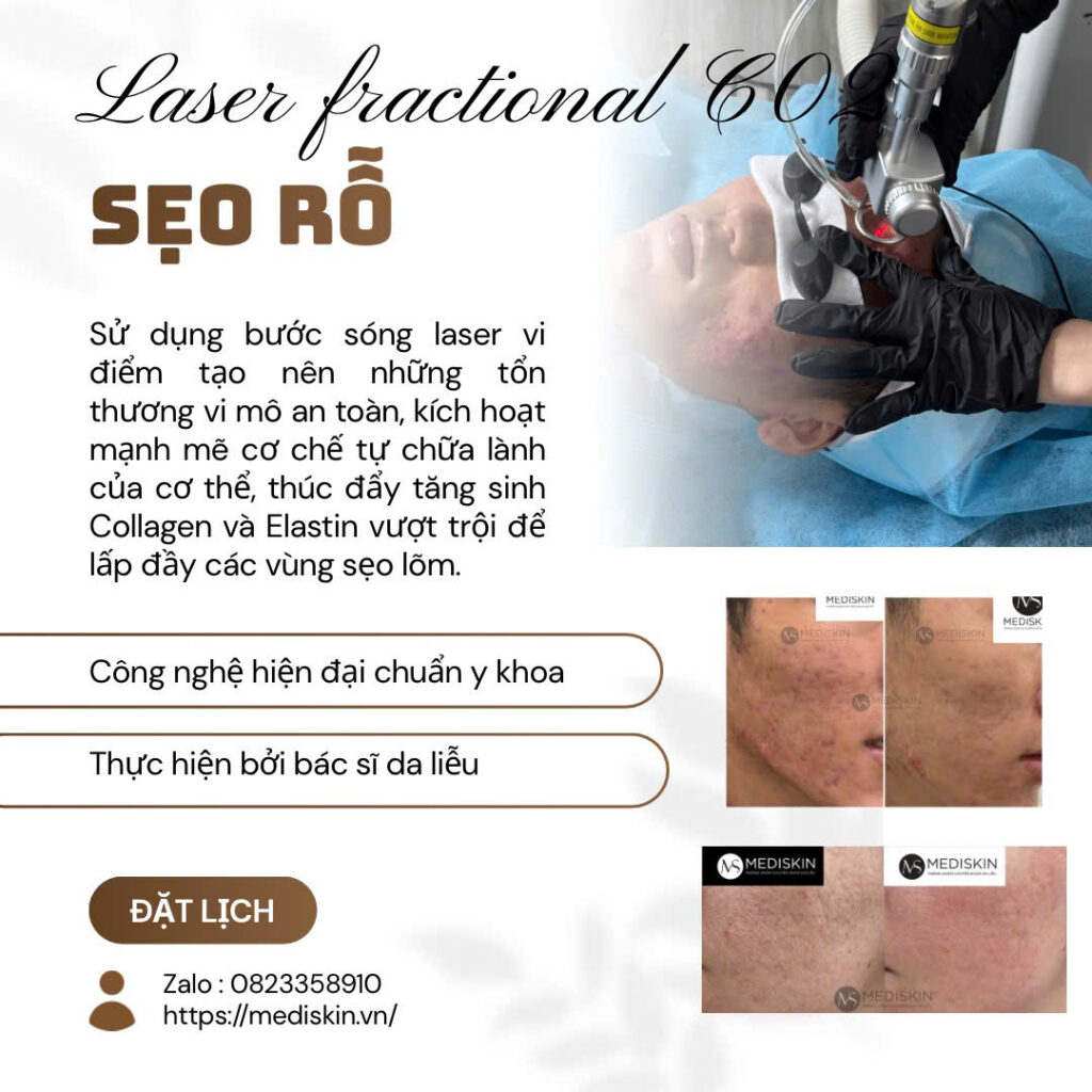 DIEU TRI SEO RO LONG AN