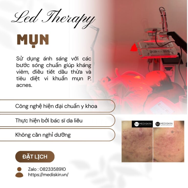 điều trị mụn long an