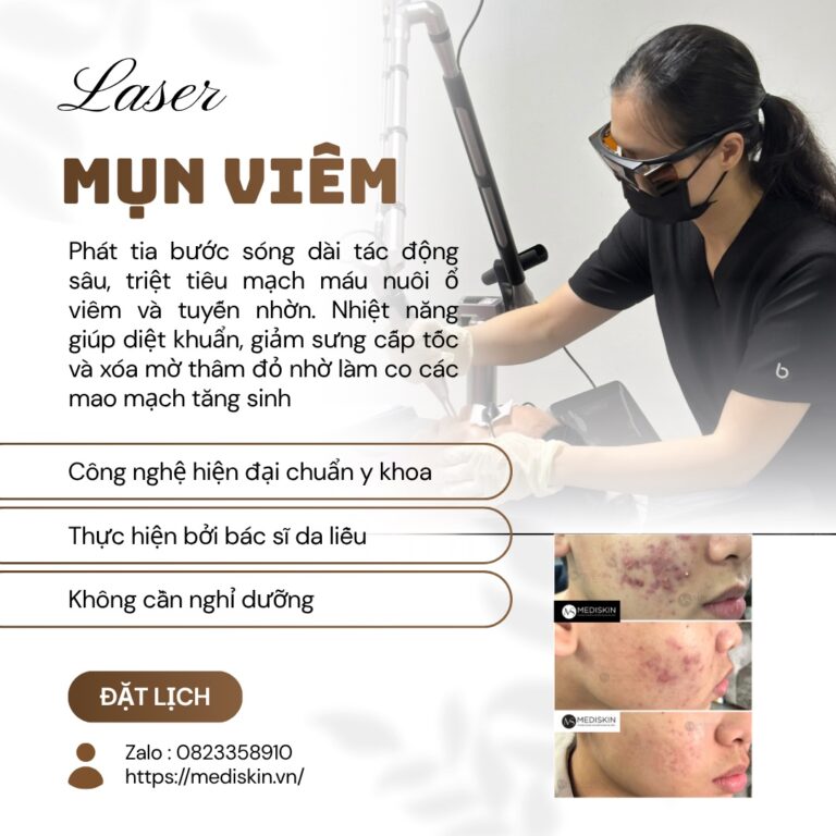 điều trị mụn long an