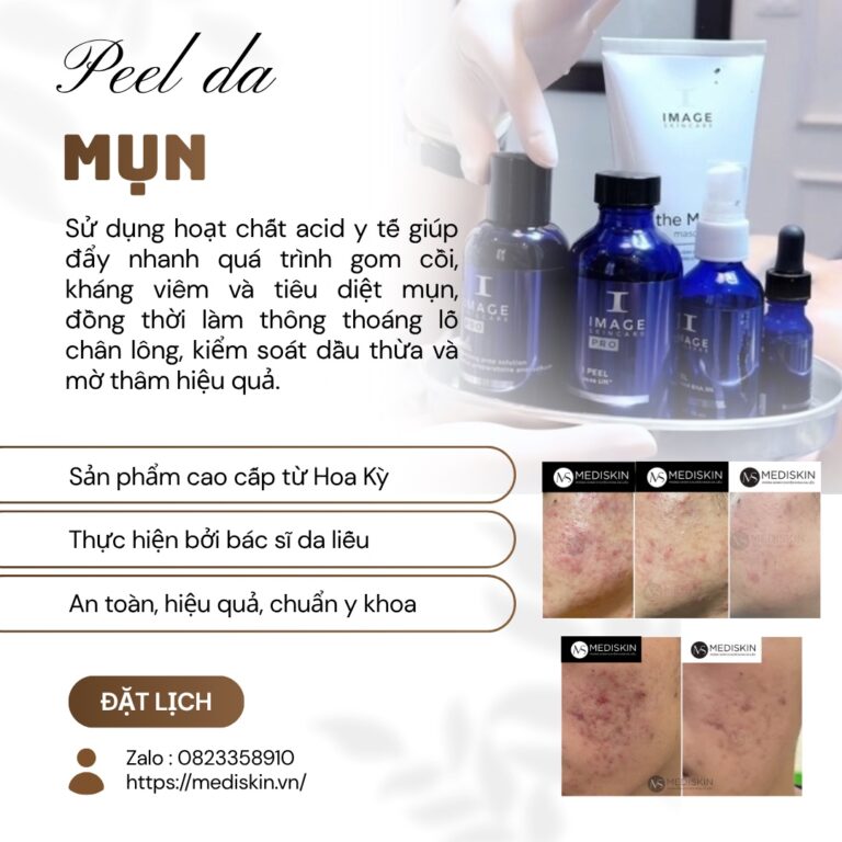 điều trị mụn long an