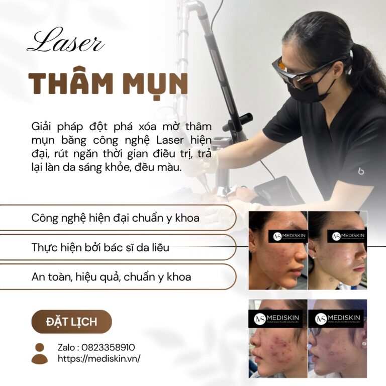 điều trị thâm mụn long an
