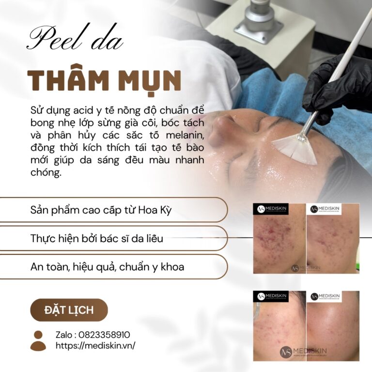 Peel da thâm mụn long an