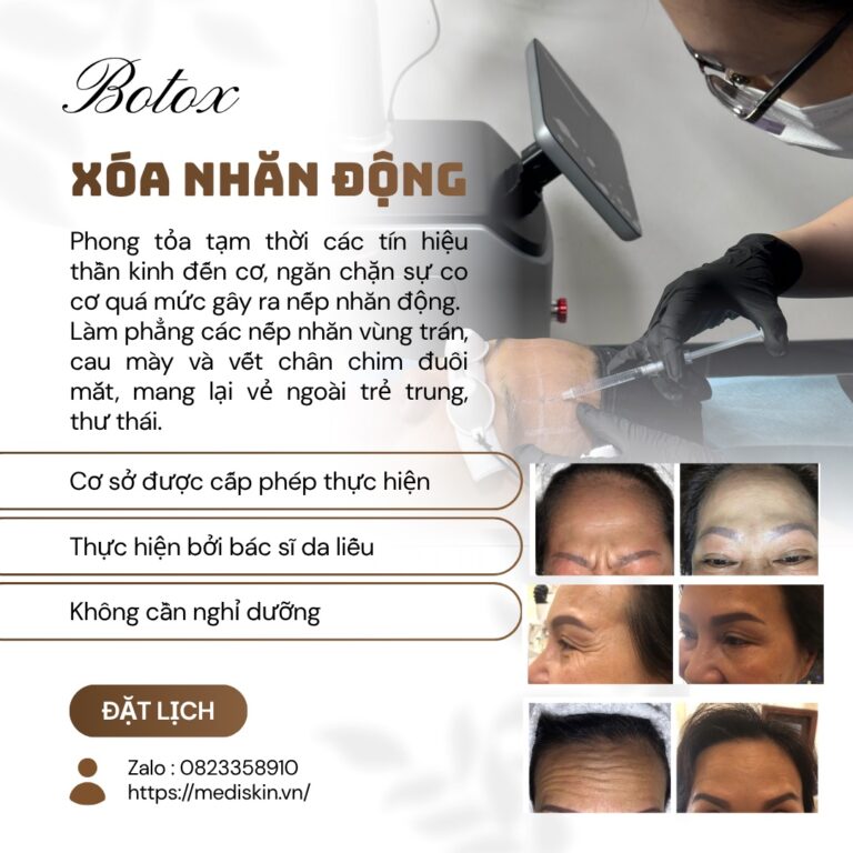 TIÊM BOTOX LONG AN