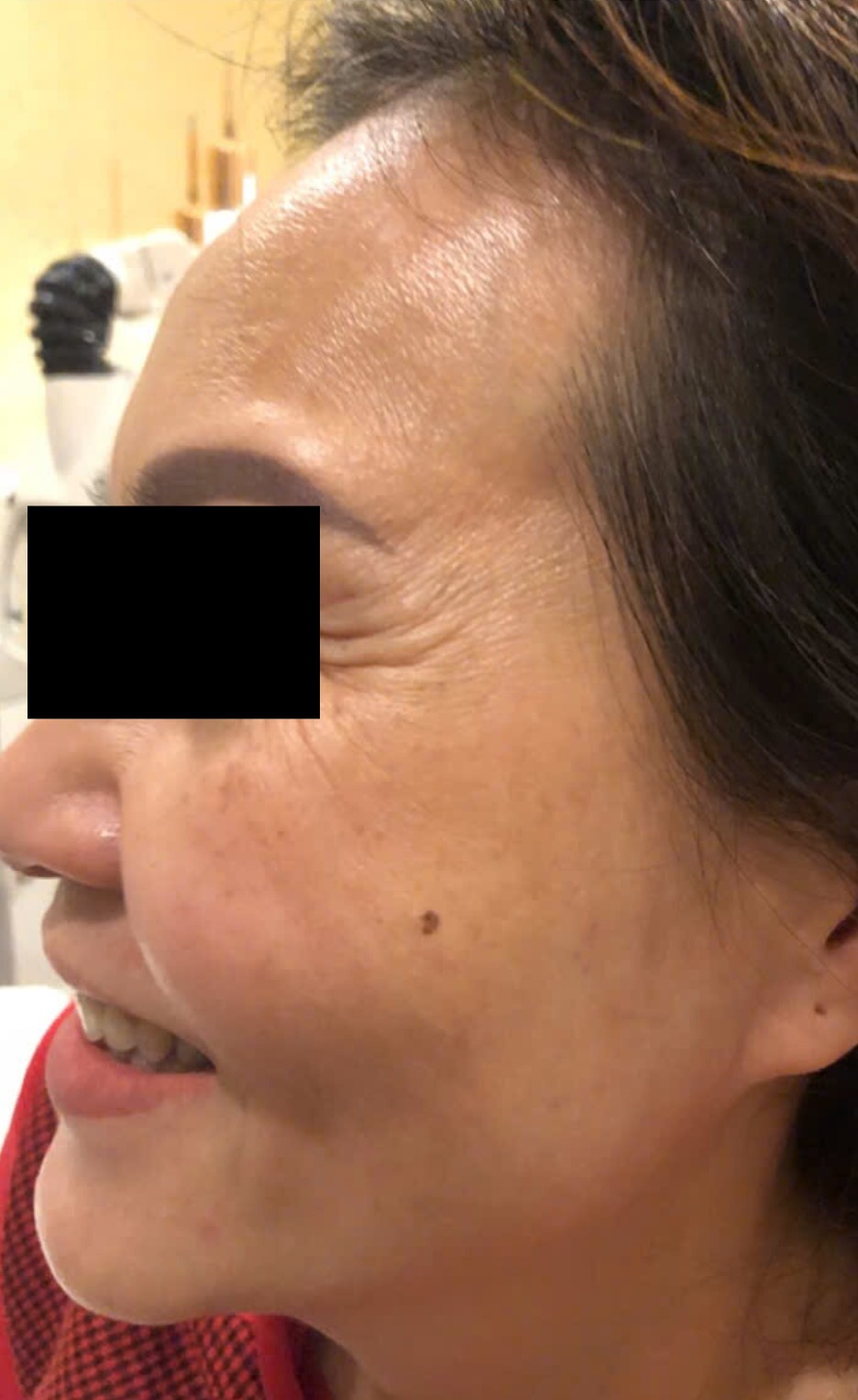 Sau dieu tri tai MediSkin Long An